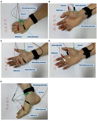 abductor pollicis brevis - List of Frontiers' open access articles